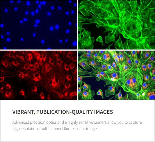 Celena S imaging modes