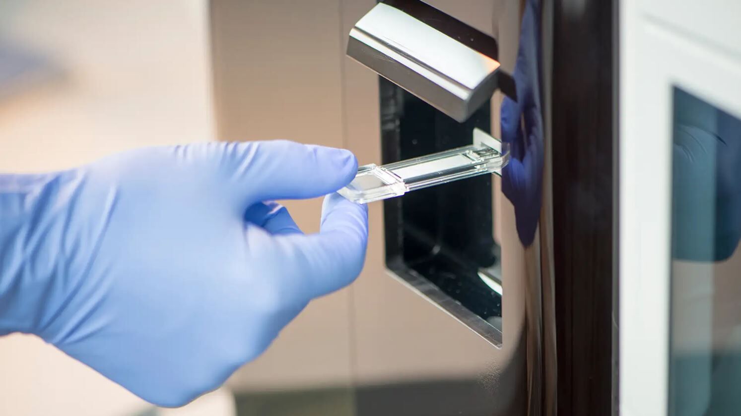 No-clog microfluidic sensor chip