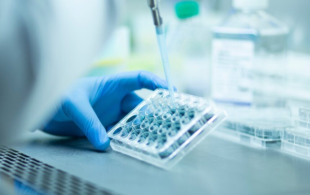 5 Step Guide to Improving the Accuracy of Automated Cell Counting