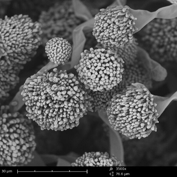 The Applications and Practical Uses of Scanning Electron Microscopes
