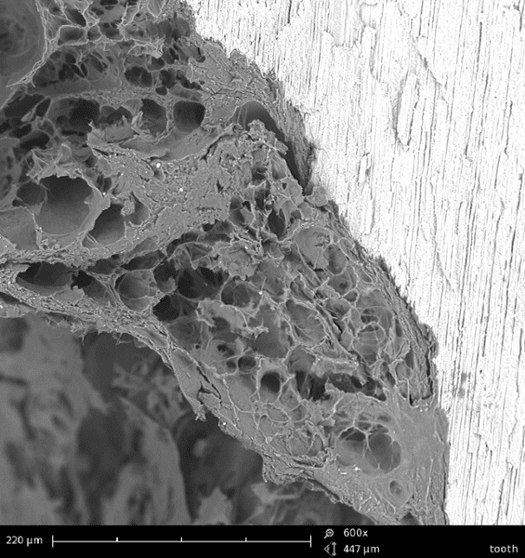 Dental Applications of Scanning Electron Microscopes