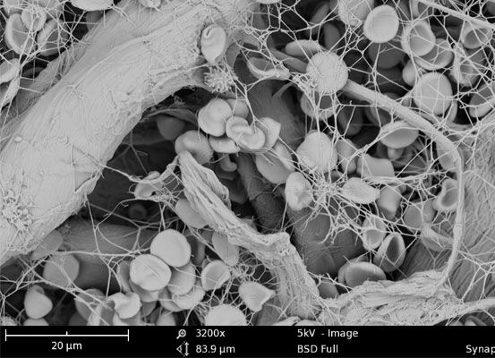 SEM image Blood Clotting